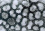 virus chřipky foto Wikimedia Commons